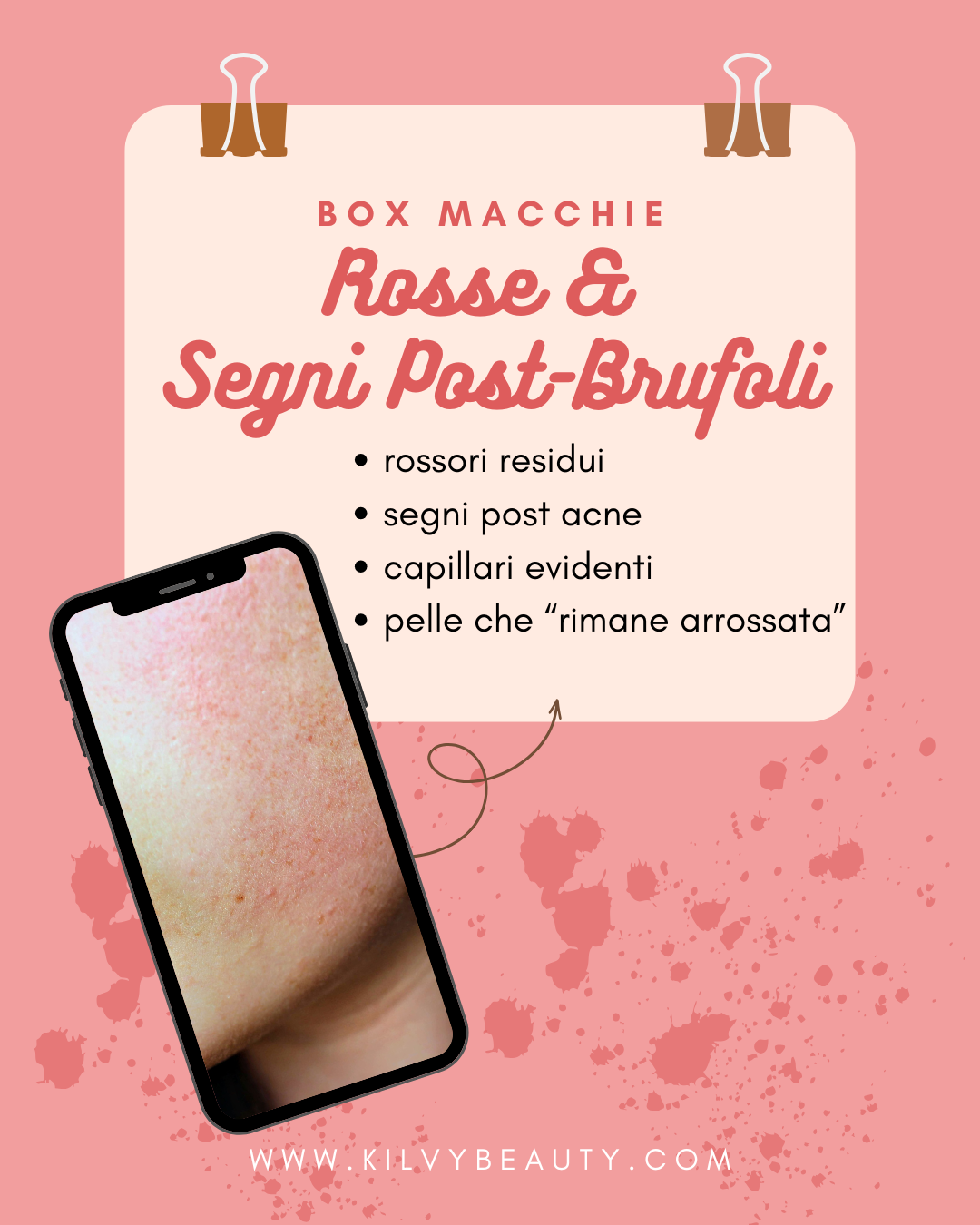 BOX Macchie Rosse & Segni Post-Brufoli