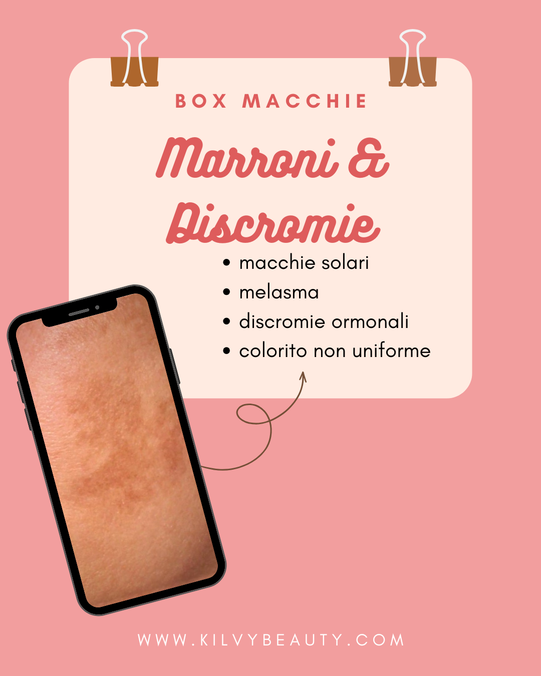 BOX Macchie Marroni & Discromie
