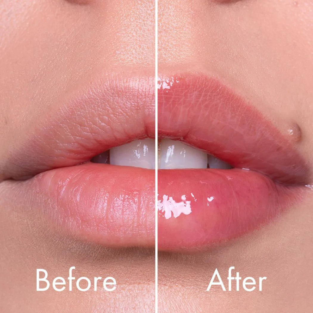 VT COSMETICS - Reedle Shot Lip Plumper Expert